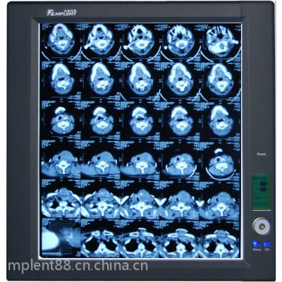 医疗医用看片灯智能调光型LED观片灯